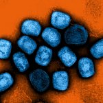 NIH releases mpox research agenda