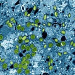 Colorized transmission electron micrograph of mpox virus particles