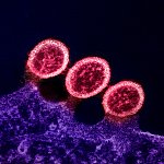 Transmission electron micrograph of HIV-1 virus particles