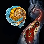NIH research reveals new insights about how 'bad' cholesterol works in the body