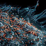 Scanning electron micrograph of Lassa virus budding off a cell. 