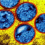 Microscopic image of immature mpox virus spheres.