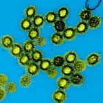 Colorized transmission electron micrograph of influenza A/H1N1 virus particles. 