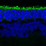 shorter rod photoreceptors next to longer rods treated with reserpine.