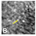 3 slides of retina tissue taken using three separate imaging techniques. Each image gets progressively clearer.