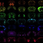 Multiple images of the mouse brain on a black background with various cells highlighted to portray the precision access of new genetic tools developed. 