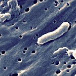 Photograph of long, tubular bacterium