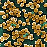 Clusters of round, golden bacteria