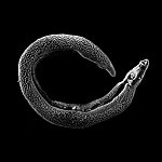 Microscopic worm curled into C shape