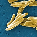 Electron micrograph of tuberculosis bacteria