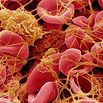 Image of clotted blood cells