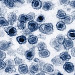 Transmission electron micrograph of round virus particles