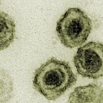 Transmission electron micrograph of round virus particles