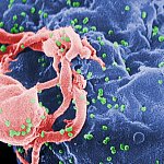 Scanning electron micrograph of HIV-1 virions budding from a cultured lymphocyte.