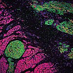 Confocal micrograph of green and pink patches of cells.