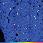 Mouse heart cells with brightly colored nuclei.