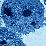 Transmission electron micrograph of a lymphoblast.