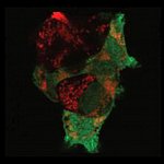 Parkin and mitochondria