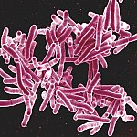 A group of strand-like bacteria.