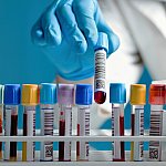 Scientist taking a blood sample tube from a rack.