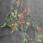 Electron micrograph of Salmonella bacteria and β-amyloid in mouse brain.