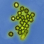 Colorized electron micrograph of H1N1 influenza virus particles.