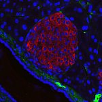 Immunofluorescent microscope image of mouse pancreatic islet