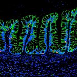 Human intestinal organoids in mouse intestine