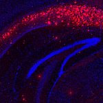 Amyloid-beta in mouse brain