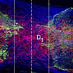 Microscope image of axons growing across a spinal cord injury