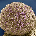 HIV-infected cell