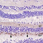 Two panel image of retinas