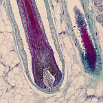 Microscope image of a hair follicle in human skin