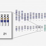 Down syndrome chromosome set