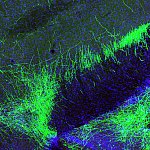 Pain suppression neurons in mouse brain.