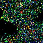 Fluorescent microscope image of neural stem cells maturing