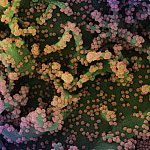 Novel Coronavirus SARS-CoV-2 Novel Coronavirus SARS-CoV-2