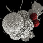 Scanning electron micrograph of cancer cell being attacked by T cells