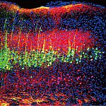 Neurons in a mouse brain’s auditory cortex