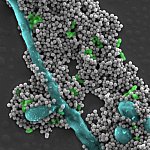 Scanning electron micrograph shows dozens of tiny gray magnetic spheres alongside common oral microbes.