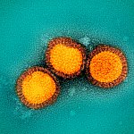 Colorized electron micrograph of three round virus particles