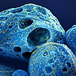 Cell with numerous SARS-CoV-2 virus particles