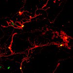 Retinal neurons glowing red, some with green nuclei