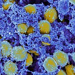 Scanning electromicrograph of Staphylococcus aureus bacteria