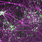 Human induced motor neurons.