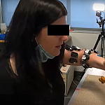 Video shows how woman has trouble eating with a fork before spinal stimulation, but can successfully use the fork to eat with the stimulation on.