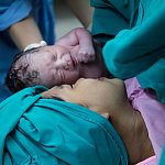 Mom and her newborn first meeting in operation room.