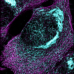 Microscope image of a cell with blue clumping throughout.