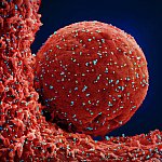 Novel Coronavirus SARS-CoV-2