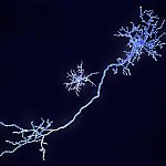 Microglial cell near the long stalk of a neuron.